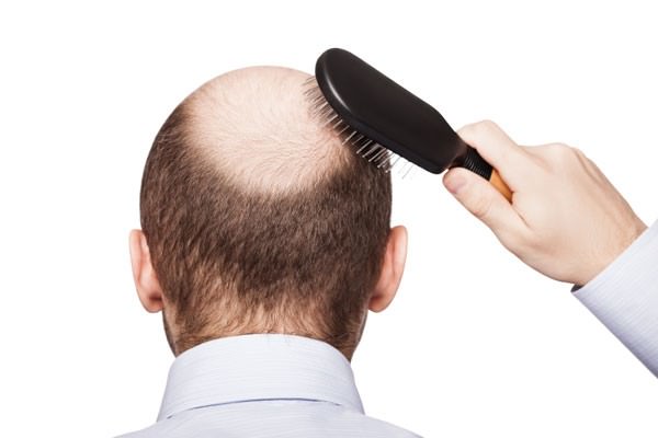Queda de cabelo: mitos e verdades