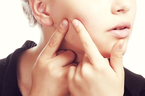8 dicas para cuidar da pele com acne