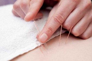 Acupuntura pode ser eficaz no tratamento da dor
